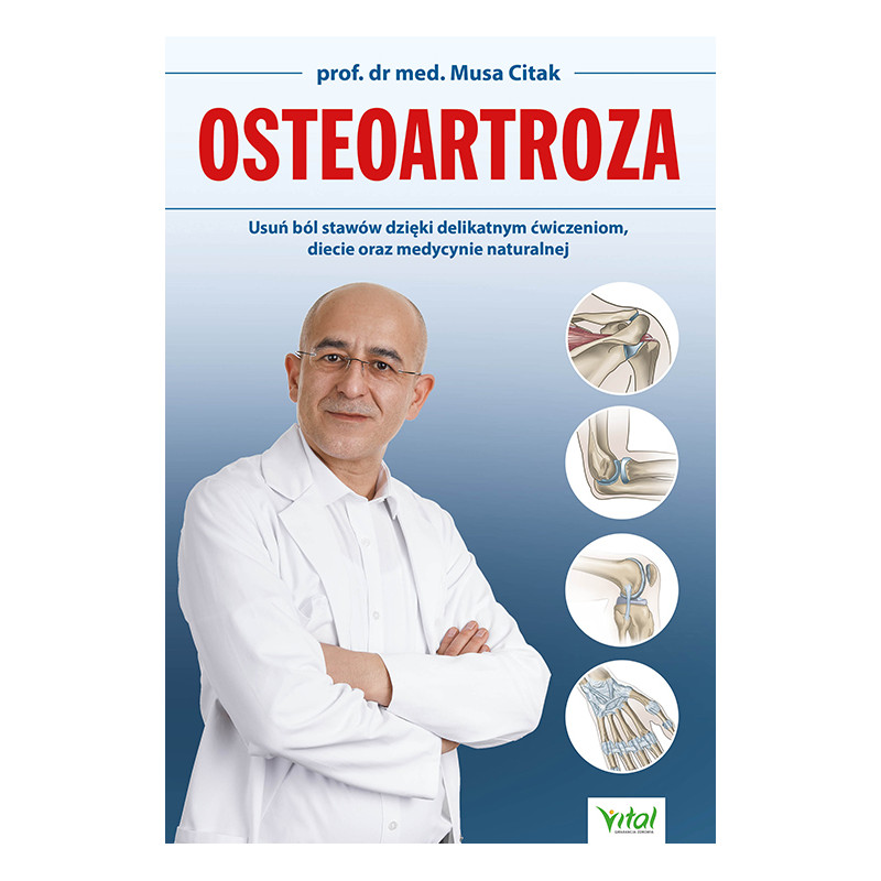 Osteoartoza Musa Citak Osteoartoza Musa Citak